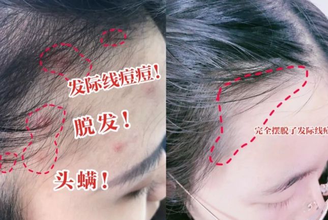 干好？10分钟轻松养成女明星「绸缎发」mg不朽情缘网站洗完头自然风干还是吹(图2)